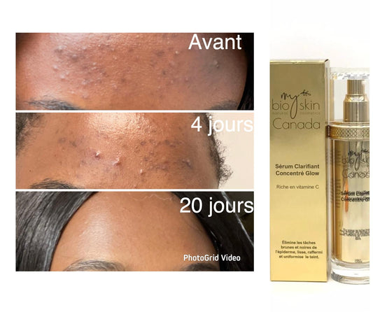 Sérum Concentré Glow Collagène & Vitamine C – Visage & Corps | Bioskin Canada